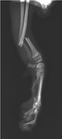 Double fracture radius-ulna chez un chien